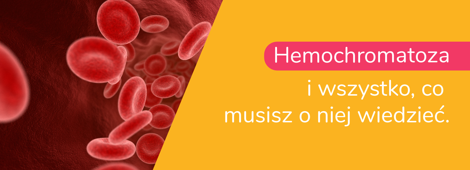 Hemochromatoza i wszystko, co musisz wiedzieć. Ogen.pl